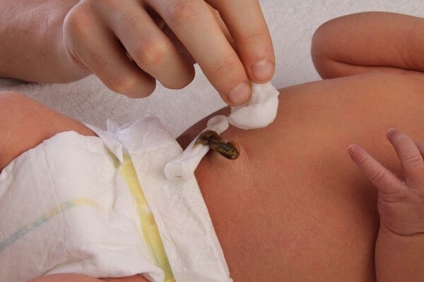 Đặt lá trầu không hoặc nhánh tỏi gần rốn - mẹo dân gian khi trẻ rụng rốn nhanh khô