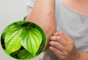 Sử dụng lá trầu không là một trong những mẹo dân gian chữa u bã đậu mang lại hiệu quả cao